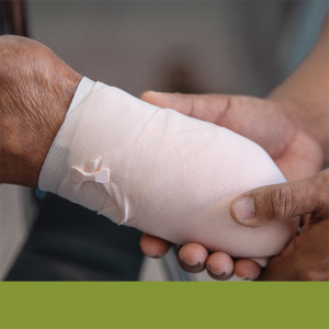 Amputações em Pacientes Oncológicos