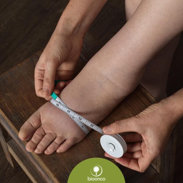 Curso | Linfedema 360º