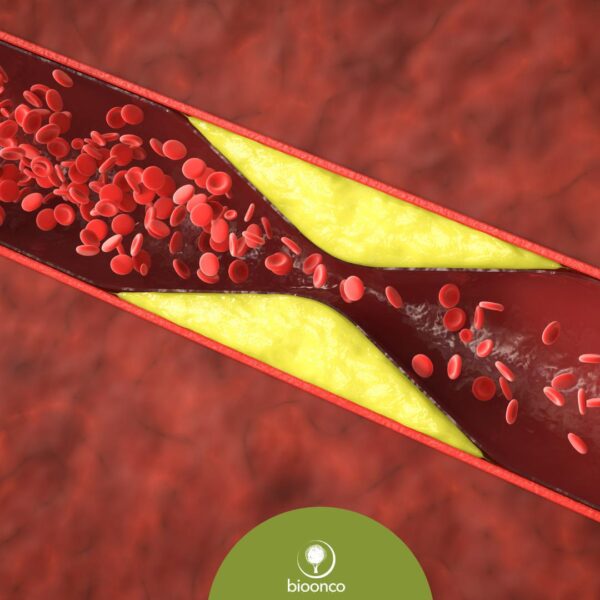 Curso | Reabilitação nas disfunções venosas: da ferida ao linfedema