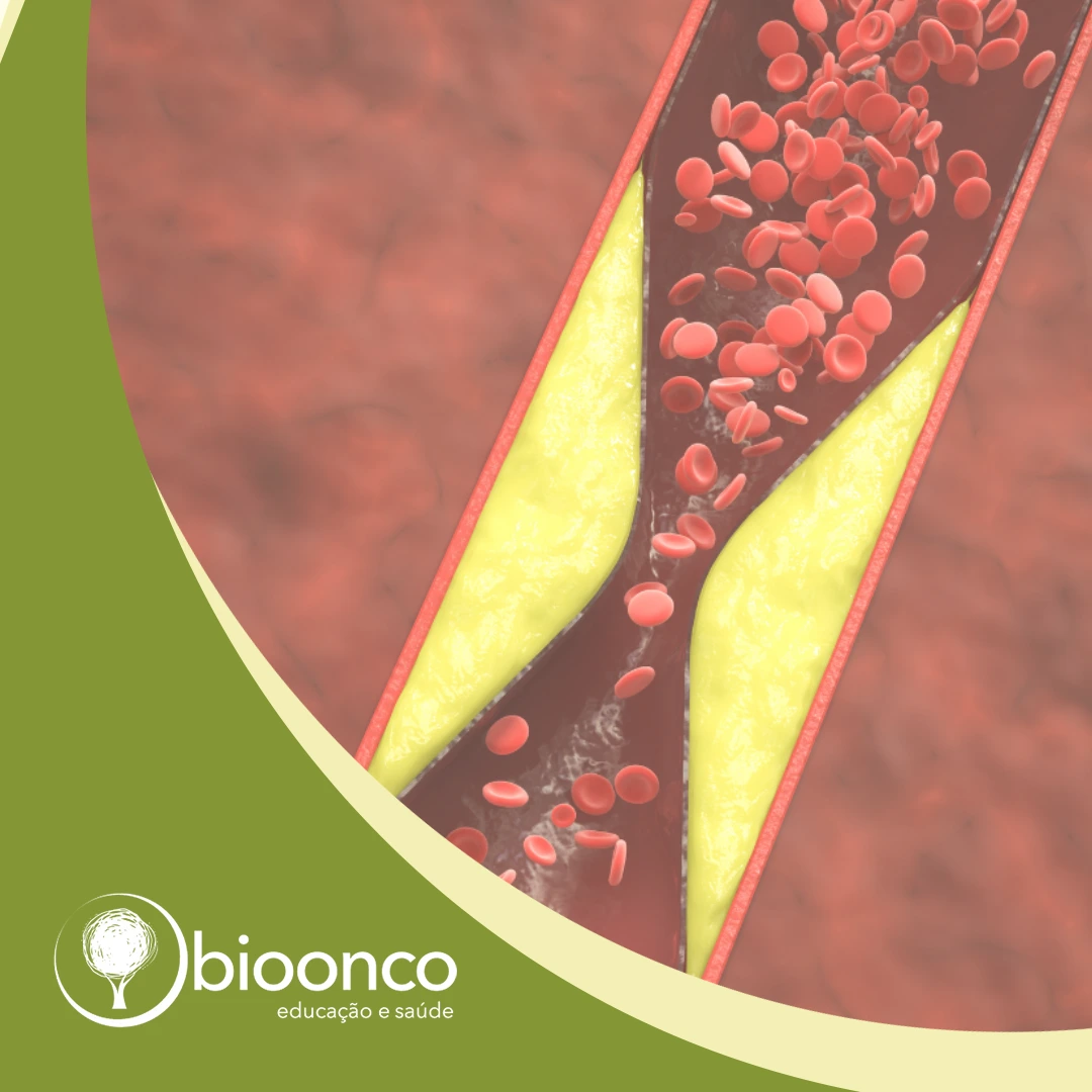 Curso | Reabilitação nas disfunções venosas: da ferida ao linfedema