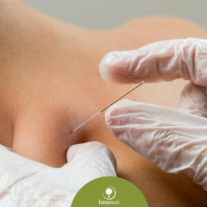Curso | Dry Needling em Oncologia - SP