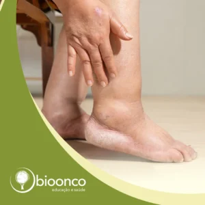 Fisioterapia en Cáncer y Linfedema